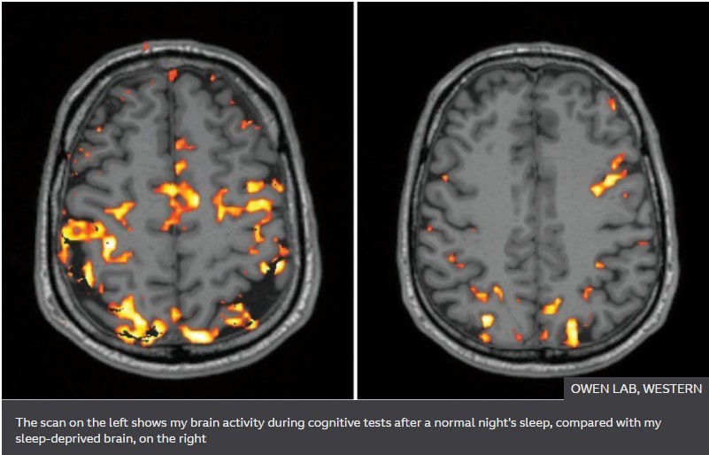 How lack of sleep affects the brain, neuroscientist Professor Adrian Owen